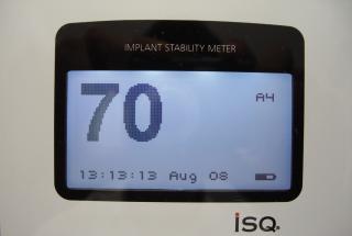 Medición de la estabilidad del implante mediante análisis de frecuencia de resonancia.
