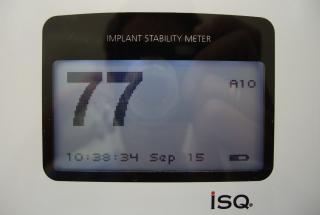 Medición de la estabilidad del implante mediante análisis de frecuencia de resonancia.