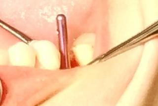 Control de paralelismo con el indicador direccional.