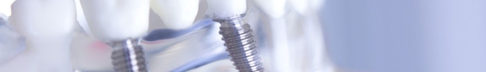 Dentsts dental prosthetic teeth, gums, roots teaching student model with titanium metal screw implant.